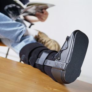 leg in cast Personal Injury Attorney Long Beach