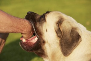 California Dog Bites Lawyers - dog biting hand