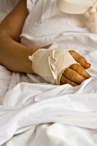 Orange County personal injury attorneys - hand injury