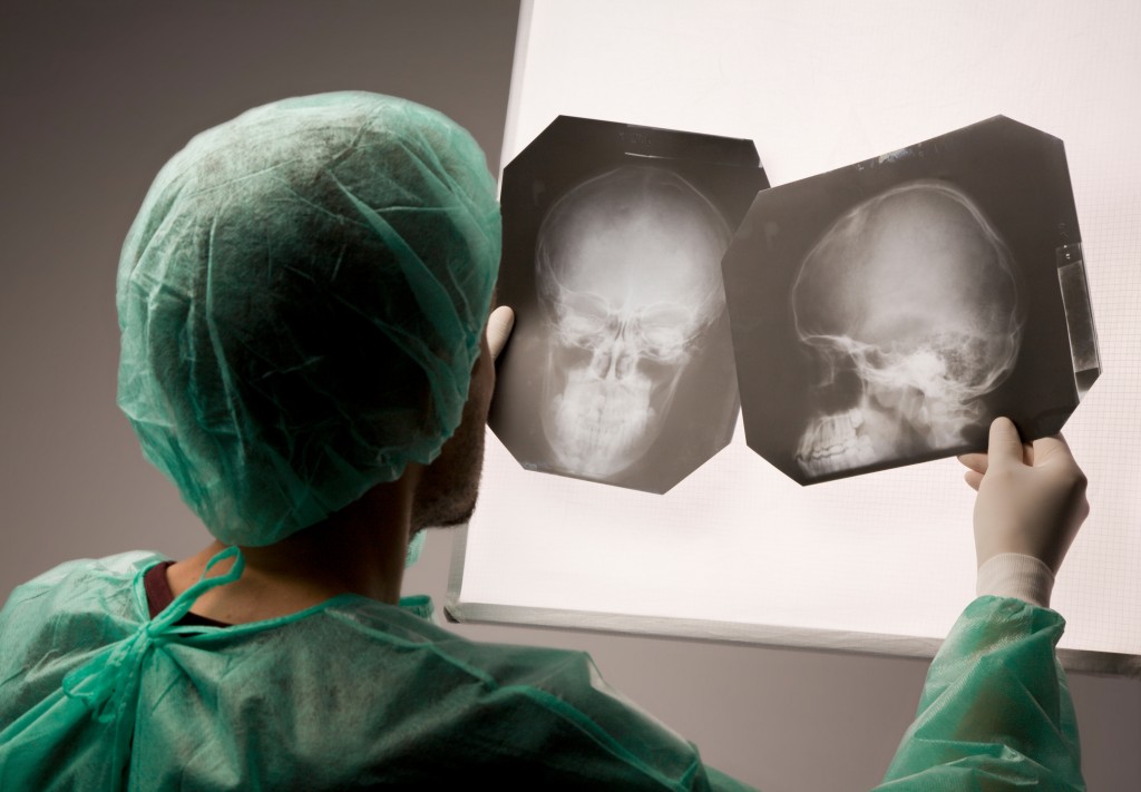 Doctor examing an x-ray Newport Beach Brain Injury Lawyers
